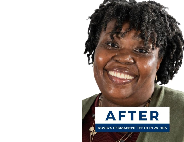 Sharala After Dental Implants
