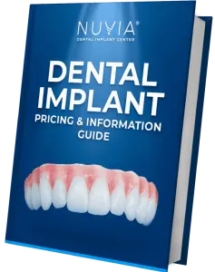 Dental Implant Cost Guide