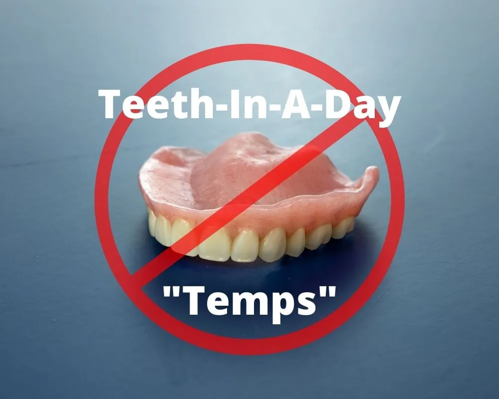 The Ultimate Guide to Full Mouth Dental Implants
