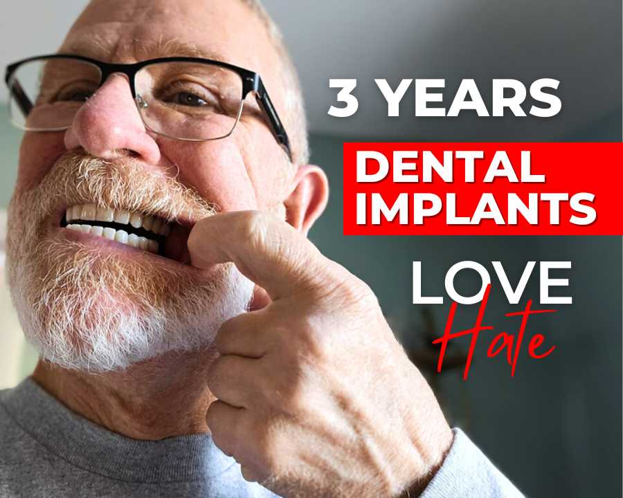 Patient before and after dental implants sharing his story