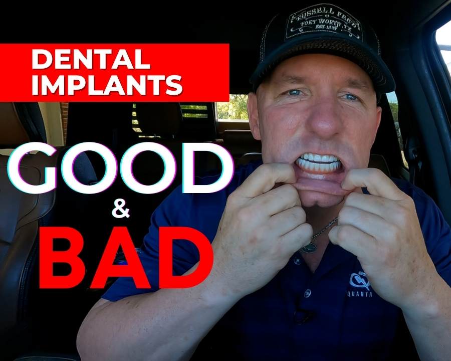 Ricky shows off his dental implants while explaining before and after dental implants