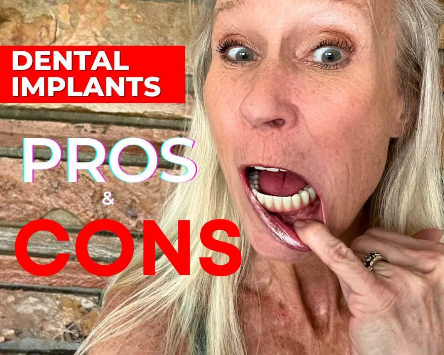 Leslie before and after dental implants sharing her experience