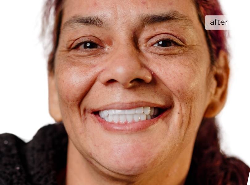 Woman smiling after getting dental implants