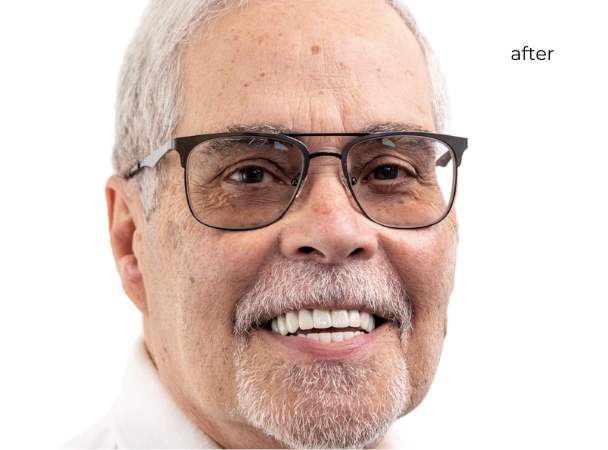 Man smiling after getting dental implants