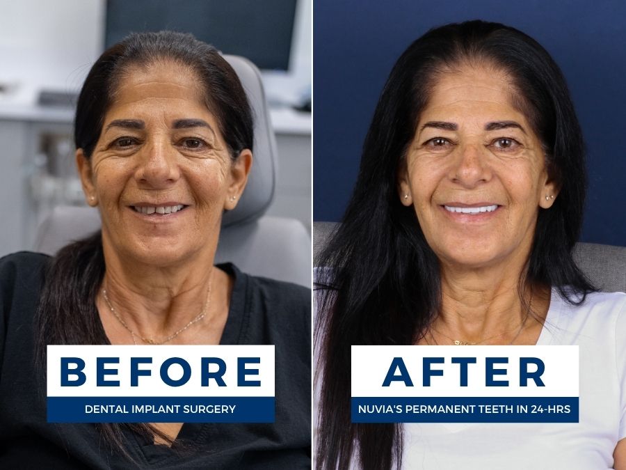 Woman smiling before and after getting new teeth with dental implants despite medical conditions