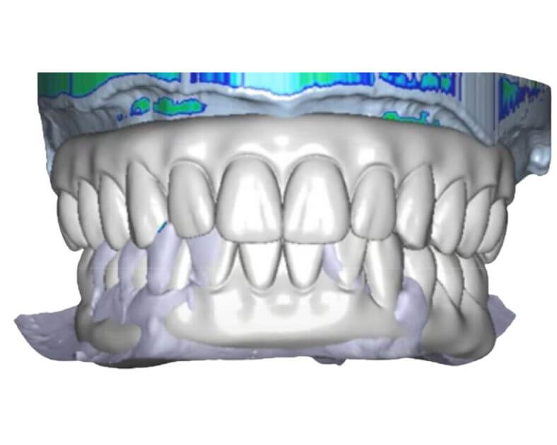3D Digital Planning