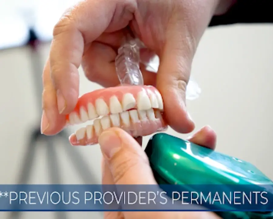 The Ultimate Guide to Full Mouth Dental Implants