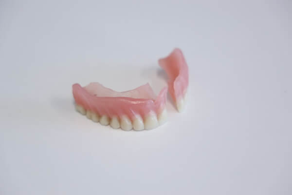 Conversion dentures that show the handmade holes used for the implants