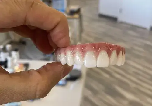 Permanent Teeth in 24 Hours