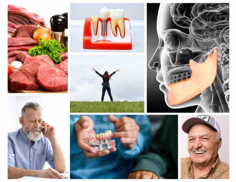 Dental Implants Improve Your Life