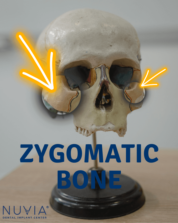 zygomatic bone