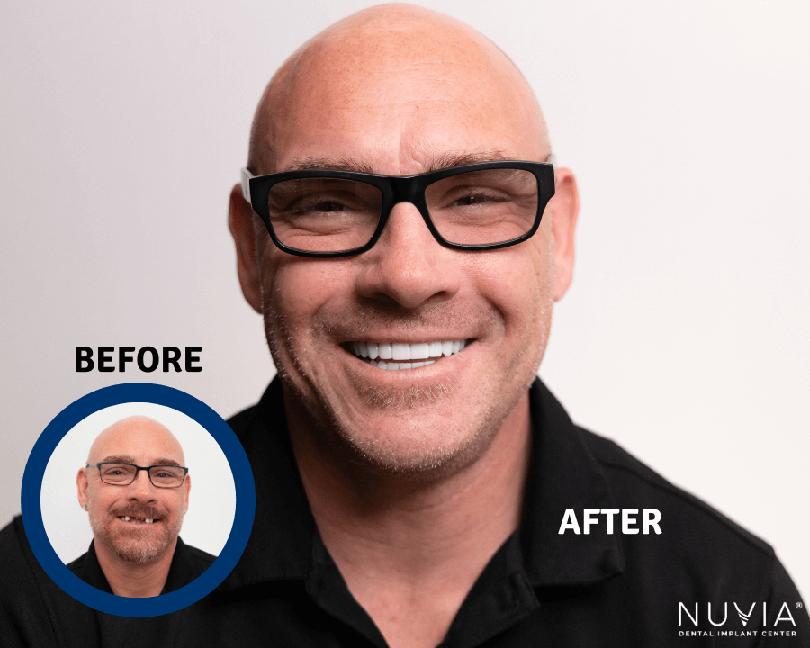 before and after