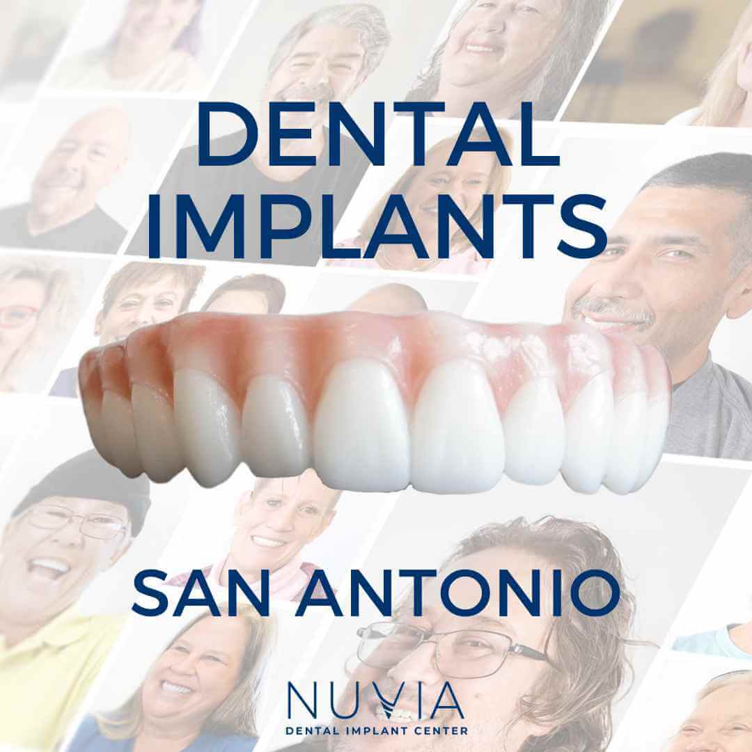 Graphic with dental implant prosthetic in Dallas