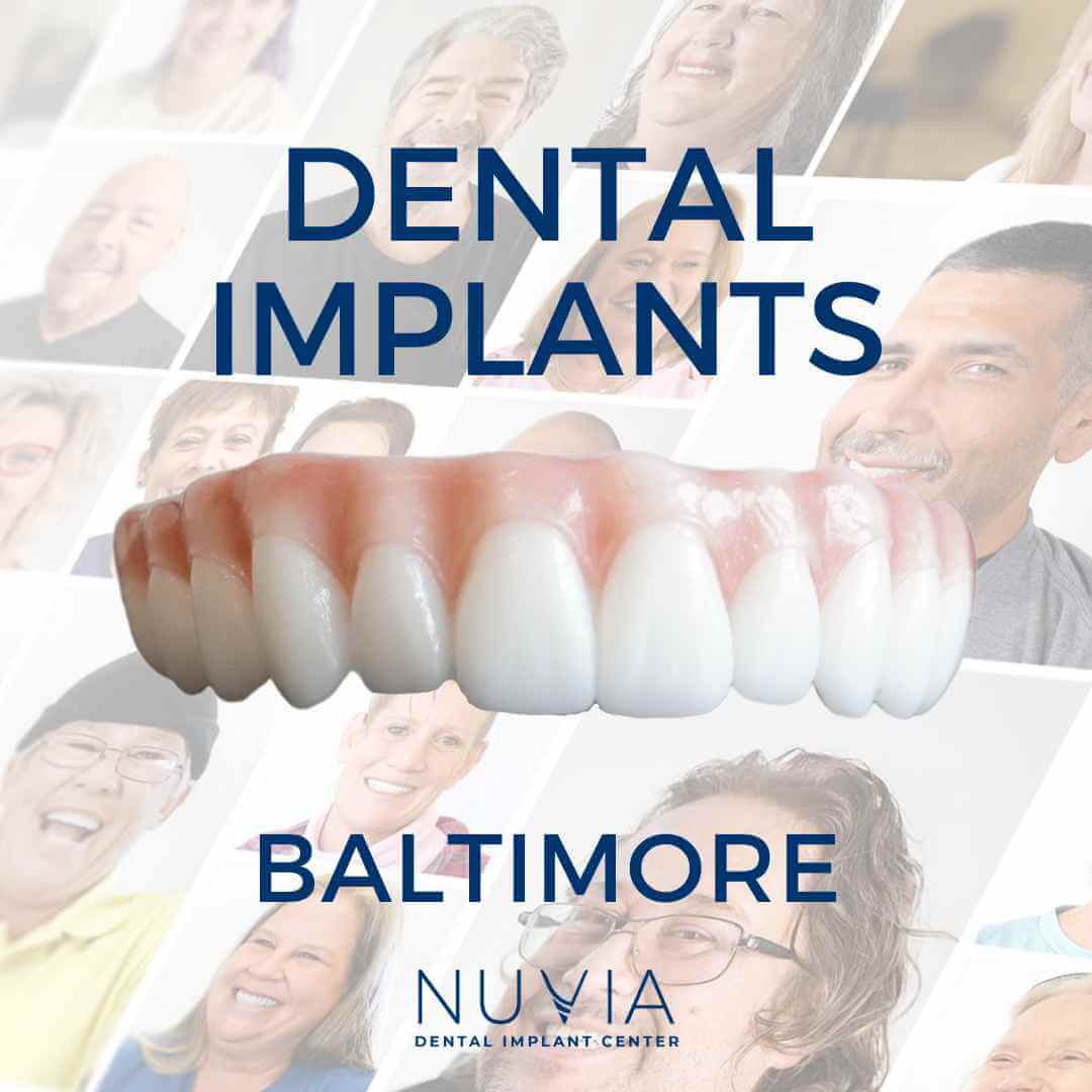 Graphic with dental implant prosthetic in Dallas