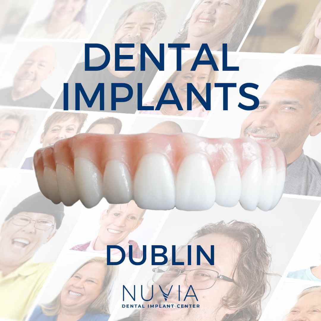 Graphic with dental implant prosthetic in Dallas
