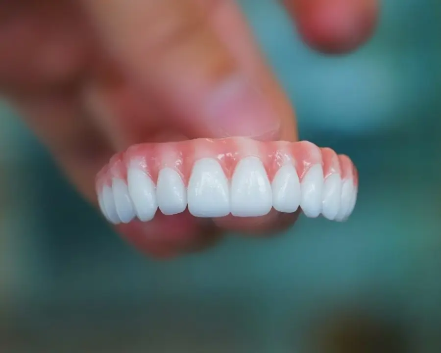 Dental Implants