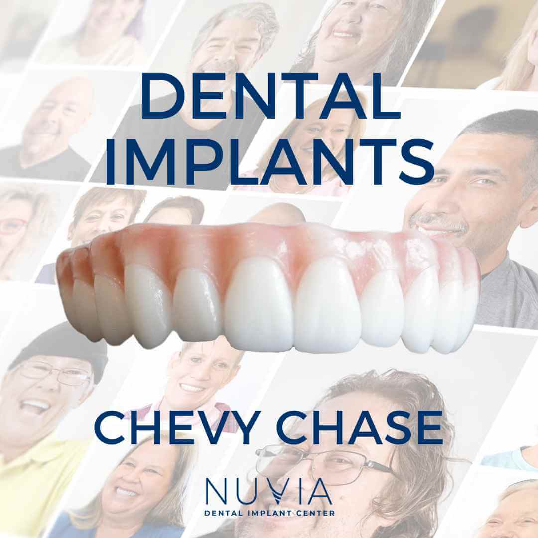 Graphic with dental implant prosthetic in Dallas