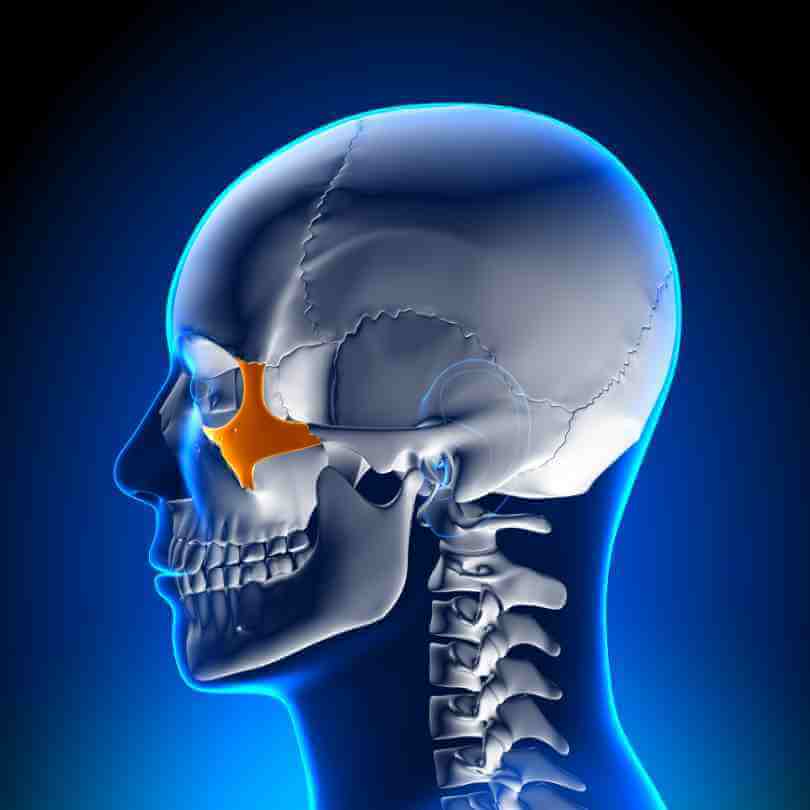 zygomatic dental implants