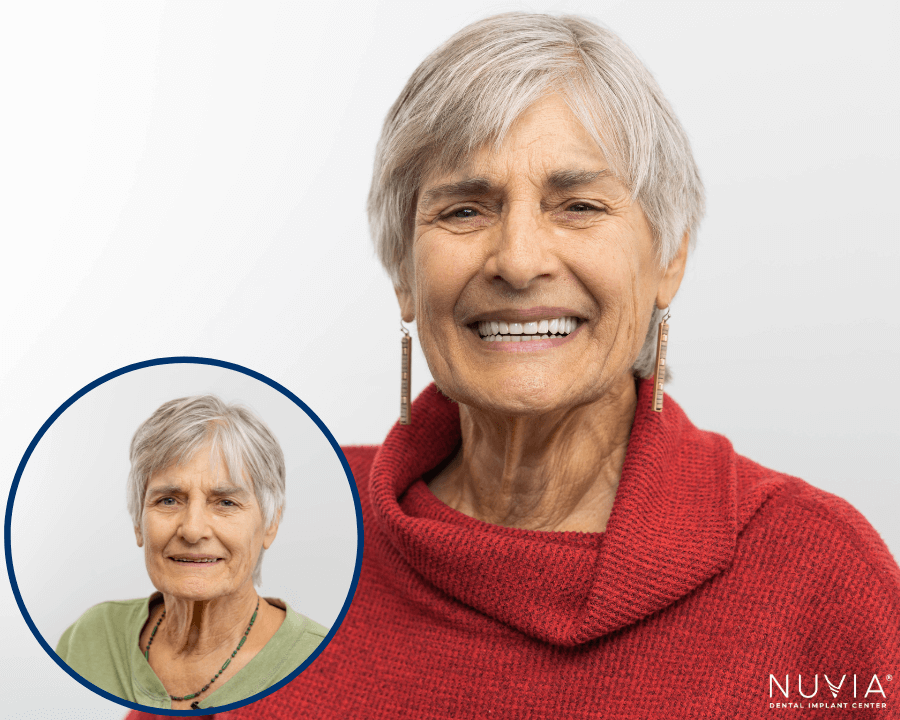 Woman smiling before and after full mouth dental implants in alexandria va