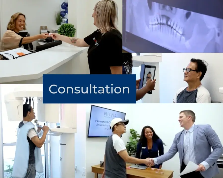 The Dental Implant Consultation Steps Collage