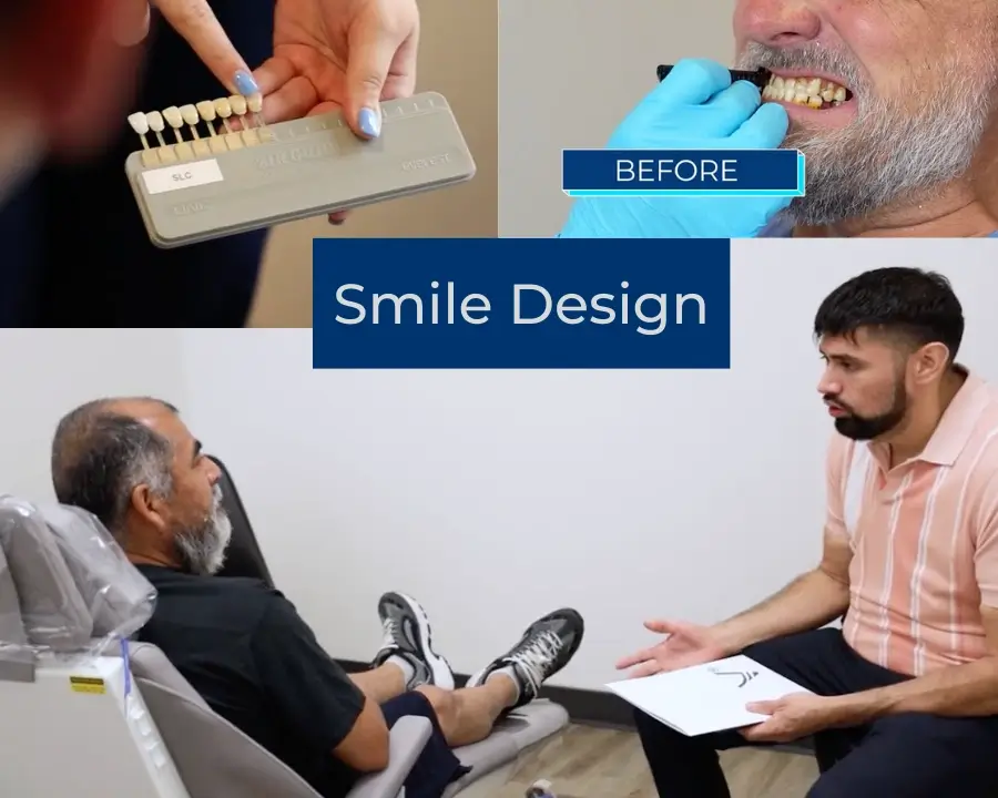 The Dental Implant Smile Design Collage