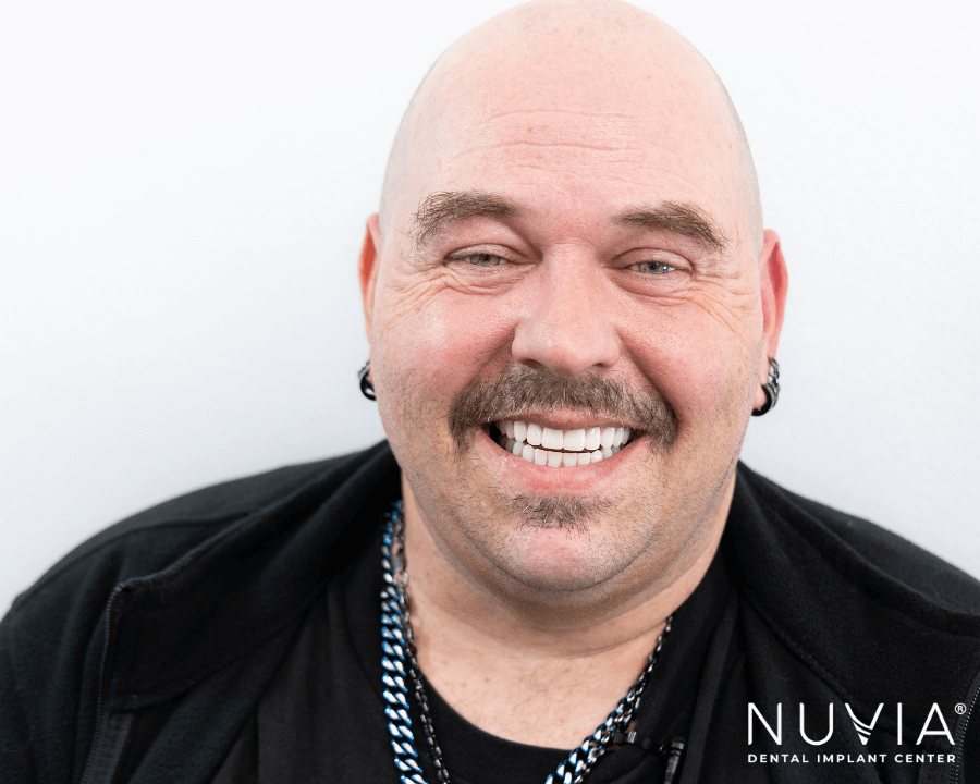 A man smiling after receiving successful full mouth dental implants