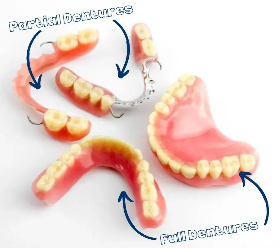 Partial Dentures vs Full Dentures