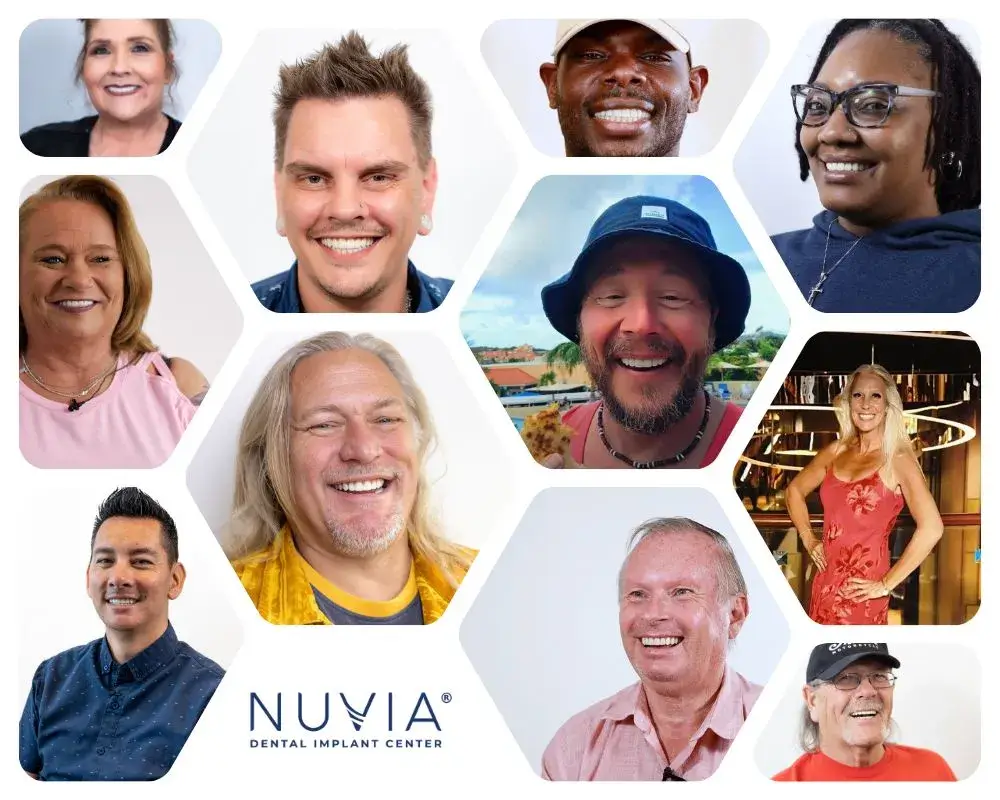 Dental Implant Patients After Photos - Nuvia Dental Implant Center