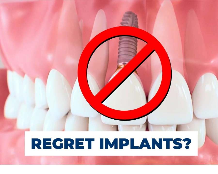 The 4 Reasons You Should NOT Get Dental Implants