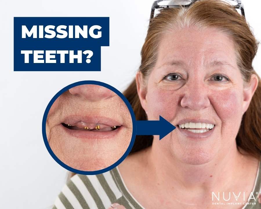 Graphic for Everything you need to know if looking to replace missing teeth