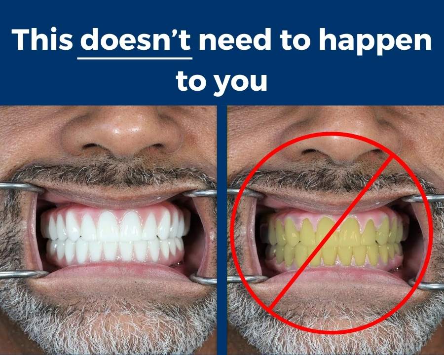 The positive effects of dental implant aftercare and what can happen if you don't