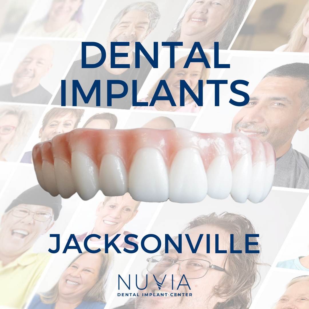 Graphic with dental implant prosthetic in Dallas