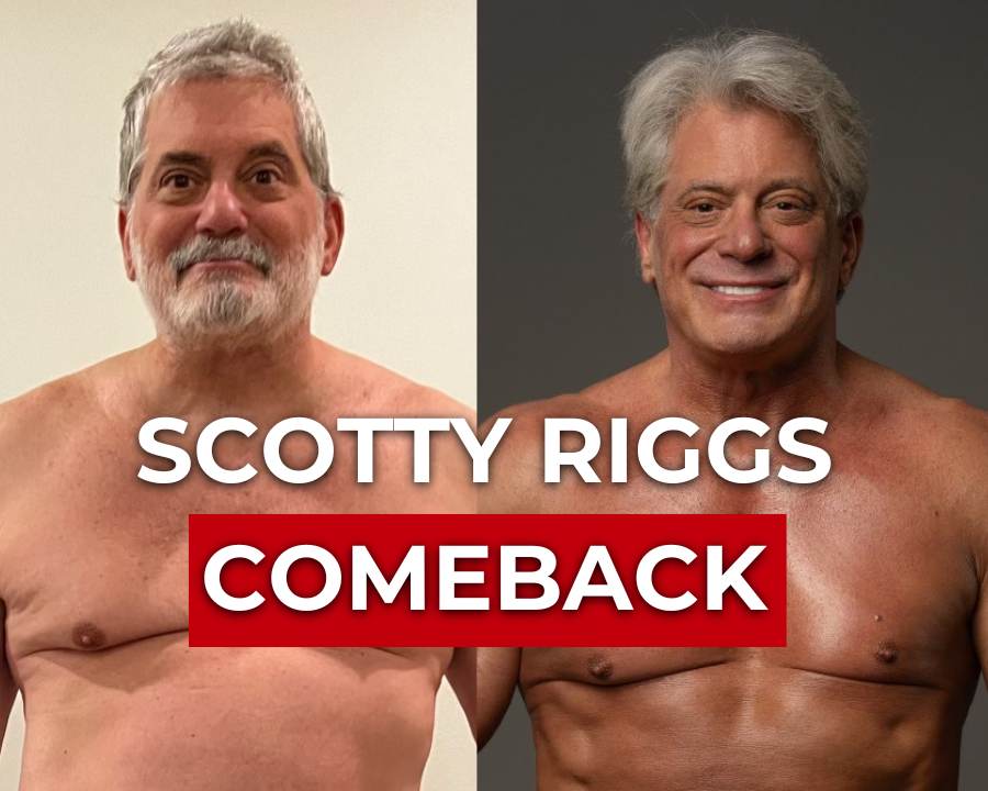 Teeth Transformation of Scotty Riggs side by side