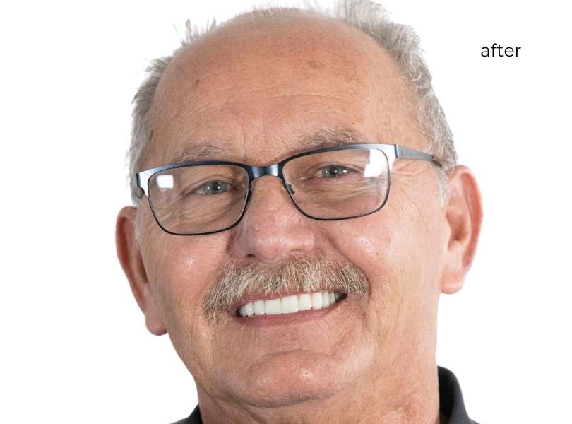 Man smiling after getting dental implants
