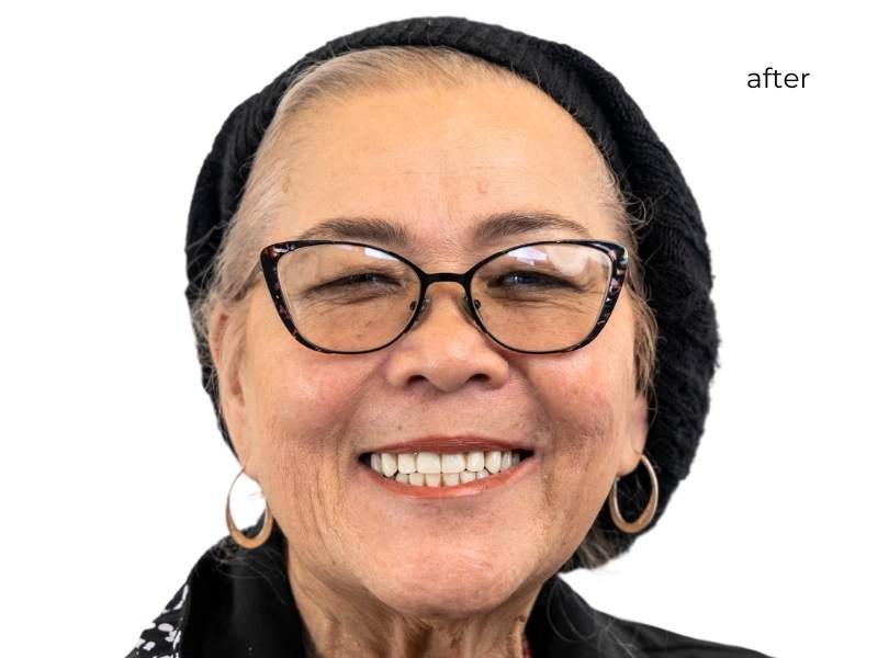 Woman smiling after dental implants