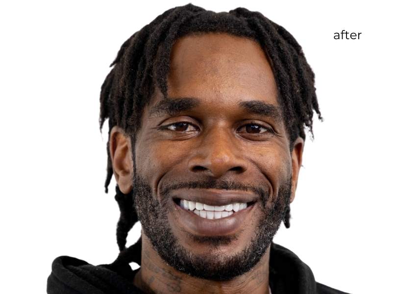 Man smiling after getting dental implants