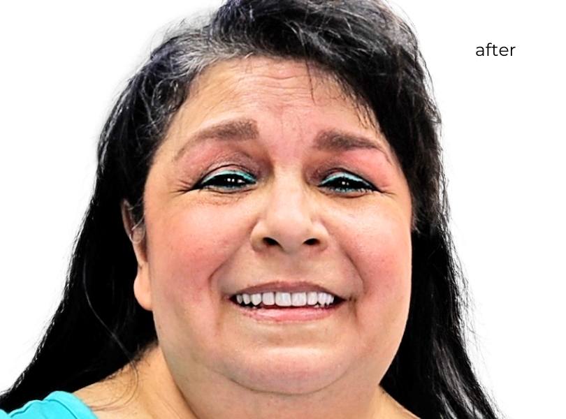 Woman smiling after getting dental implants