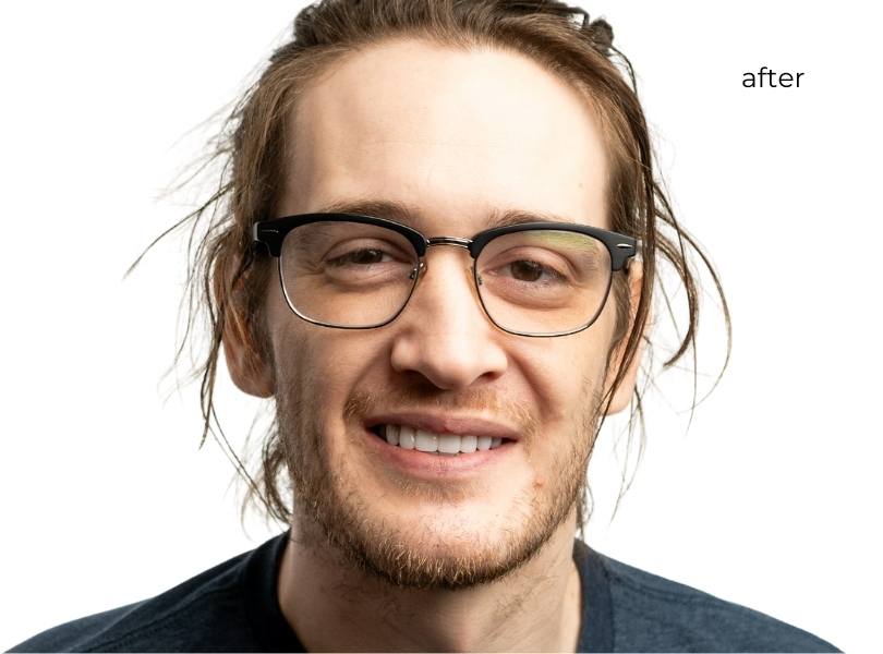 Man smiling after getting dental implants