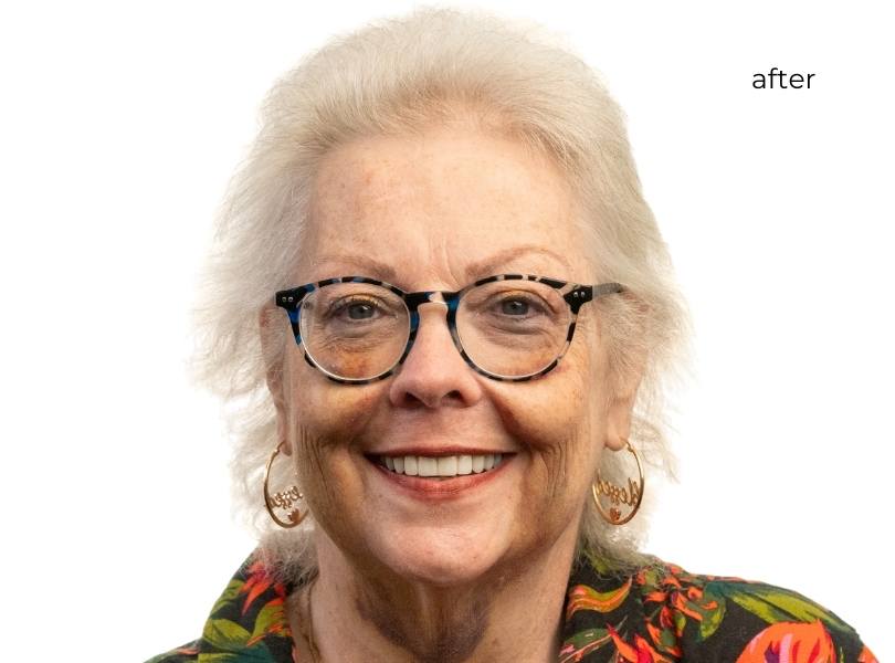 Woman smiling after dental implants