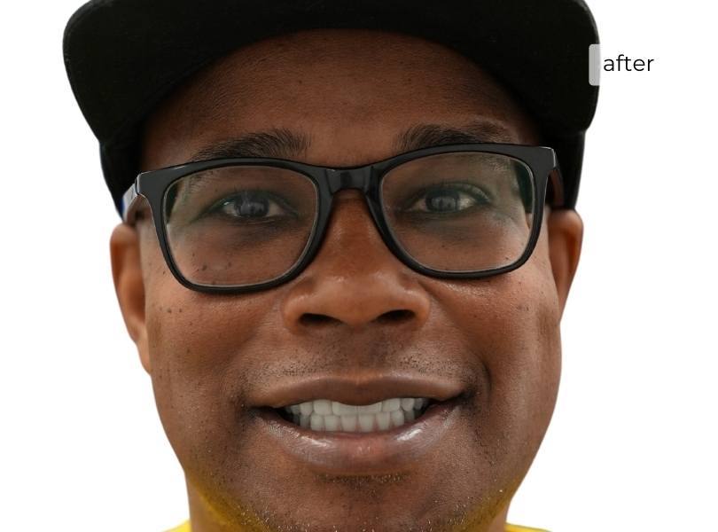 Man smiling after getting dental implants