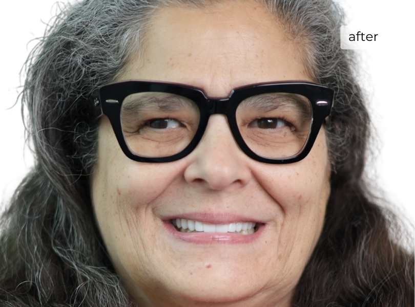Woman smiling after getting dental implants
