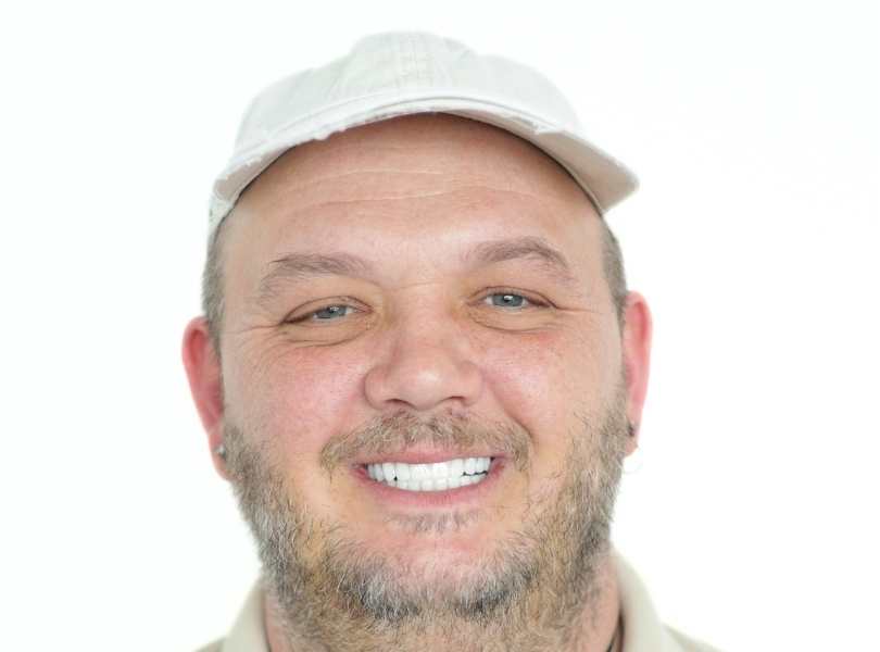 man smiling after getting dental implants