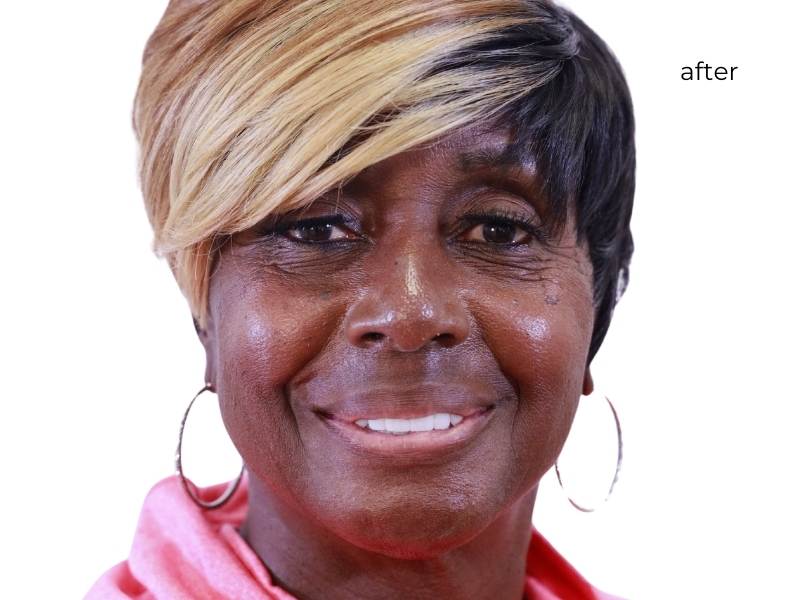 woman after getting dental implants