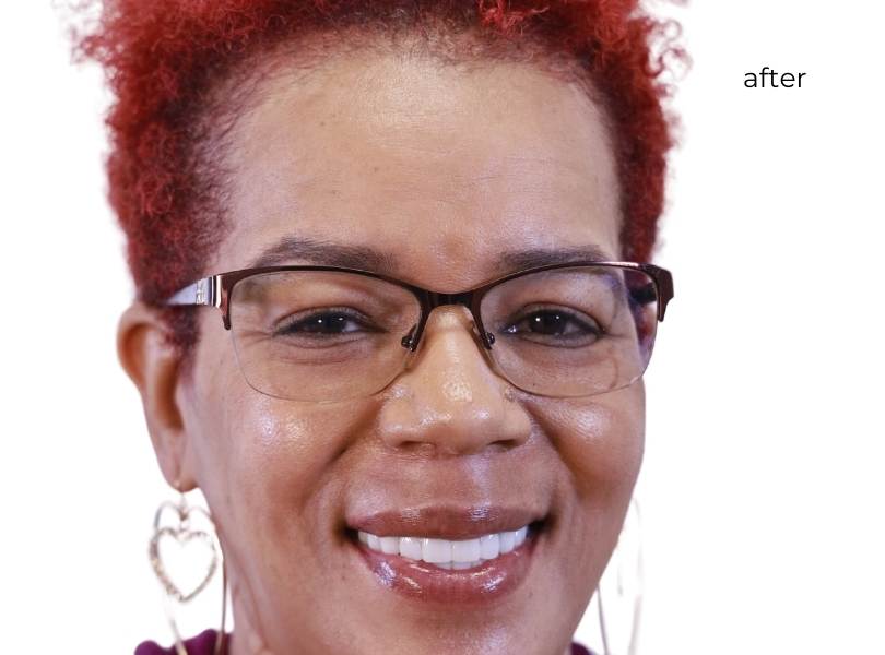 Woman smiling after dental implants