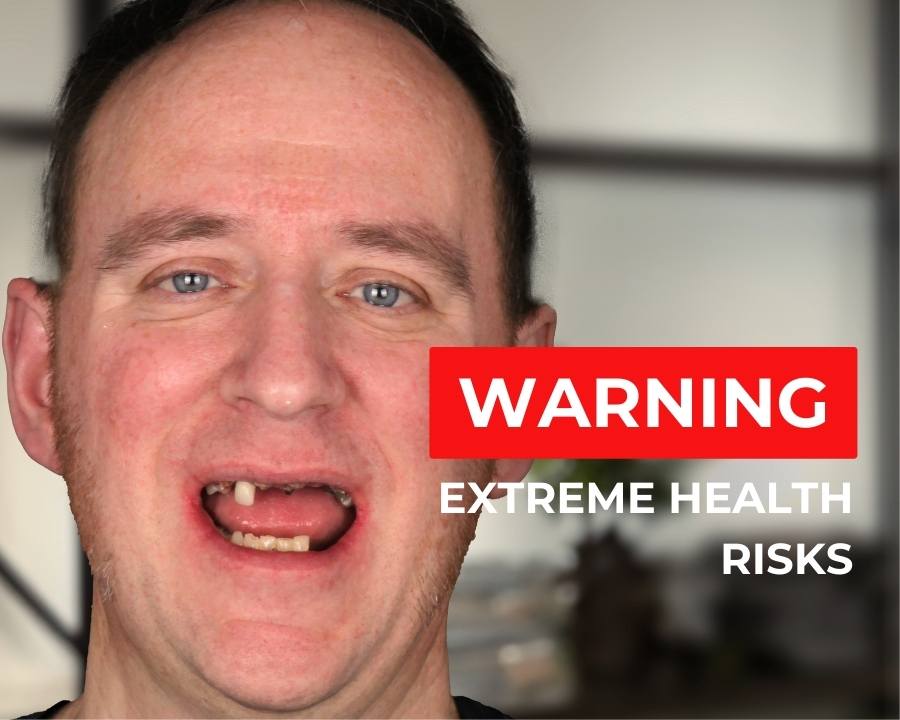 Man with tooth loss shows his mouth with text that says "warning"