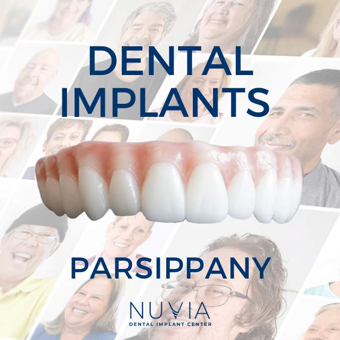 Graphic with dental implant prosthetic in Dallas