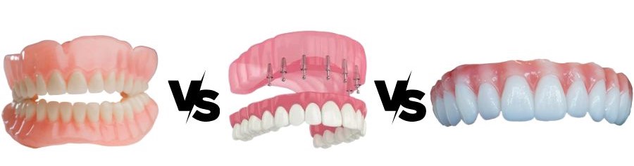 Dentures, snap ins, and dental implants compared against each other
