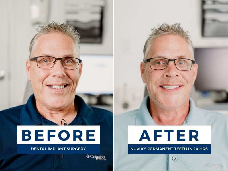 Before and after this man decided to get new teeth