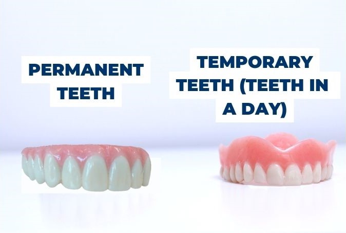 Where to get dental implants with permanent teeth in 24 hours as opposed to the temporary teeth shown below