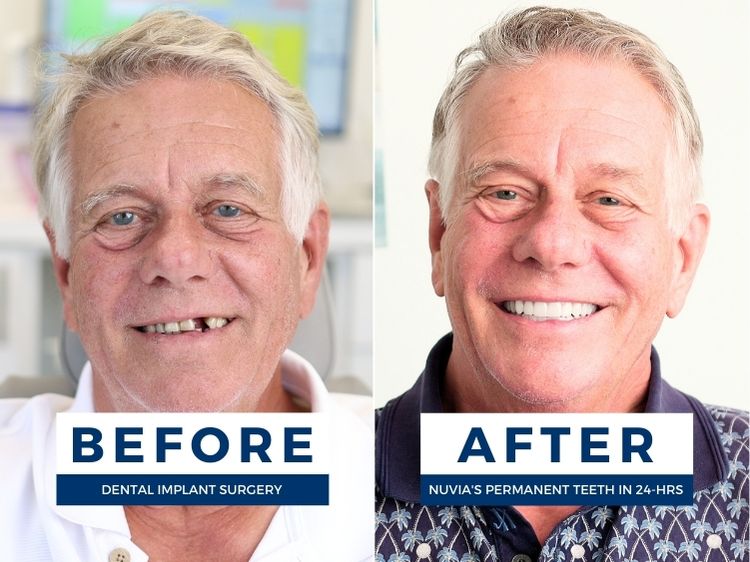 Before and after dental implant surgery where he had a protected airway